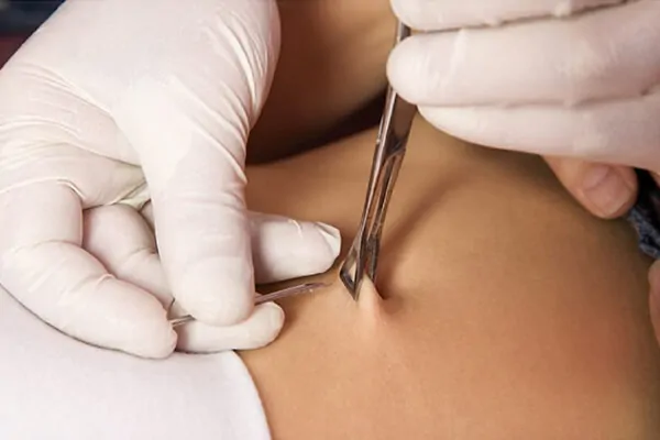 A navel piercing is being conducted using a piercing clamp and needle