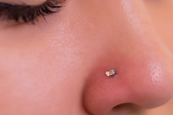 Closeup of a nose with a nostril piercing that is surrounded by small pimples 