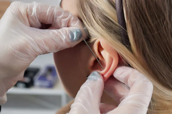 A snug piercing is placed with a piercing needle held by a white gloved hand