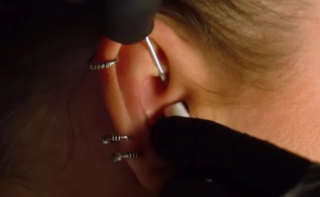 The daith is being pierced using a piercing needle and receiving tube