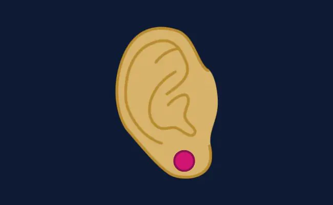 Illustration of a lobe piercing