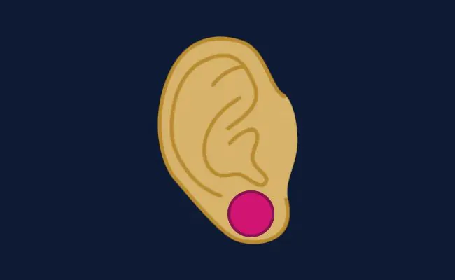 Illustration of a stretched lobe piercing