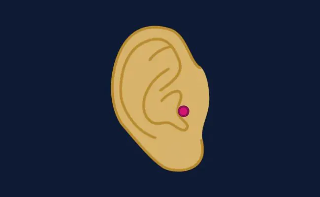 Illustration of a tragus piercing
