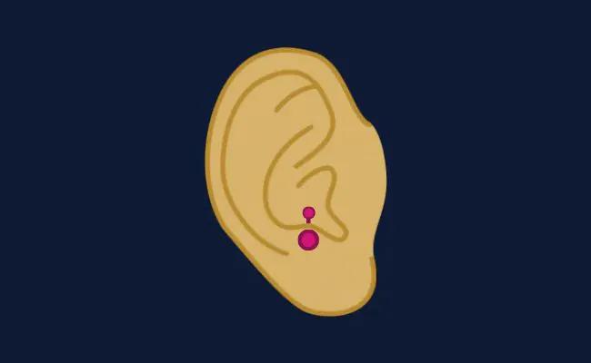 Illustration of an anti tragus piercing