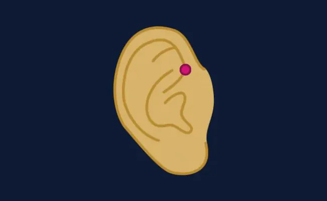 Illustration of a forward helix piercing