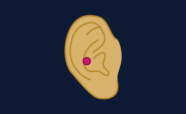Illustration of a conch piercing