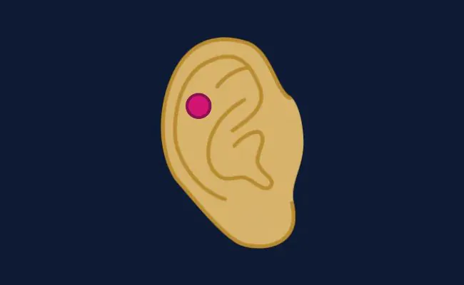 Illustration of a flat piercing