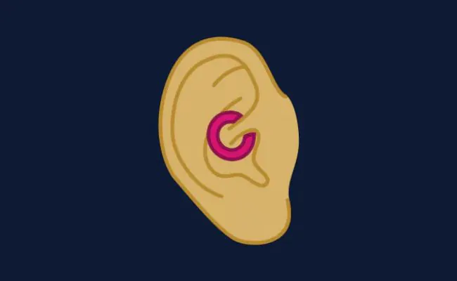 Illustration of a daith piercing