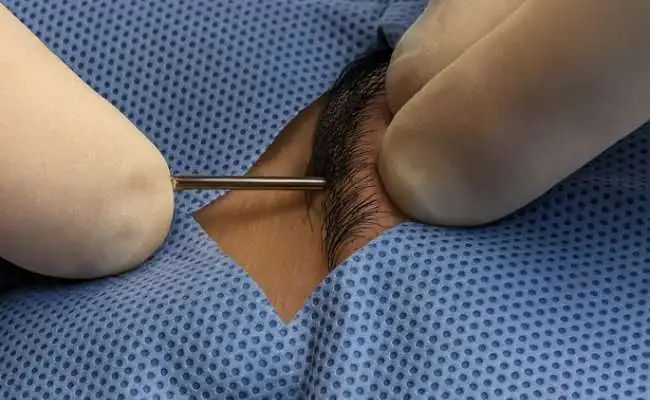 A clown eyes piercing is being done
